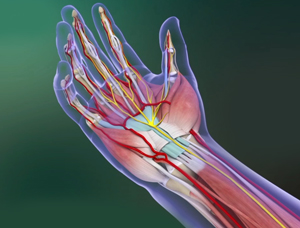 Carpal Tunnel Syndrome 3d imgae