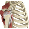 Rotator Cuff Tear