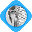 Rotator Cuff Tears Image